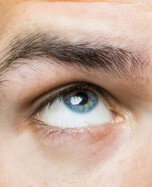 Face Restoration Eyelid Lowering Surgery