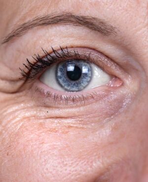 Face Restoration Tyndal Effect