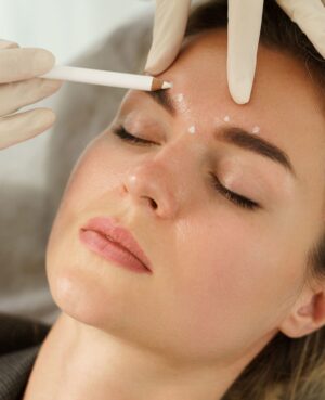Treatment FillerFacelift 1