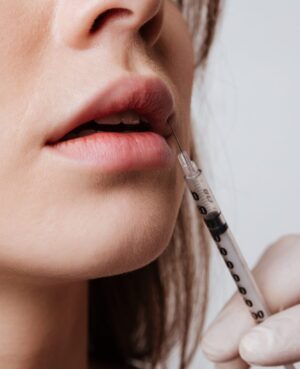 Treatment FillerRemoval