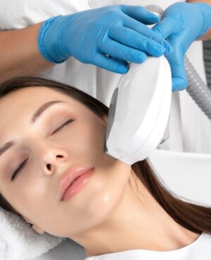 Intense pulsed light (IPL) therapy