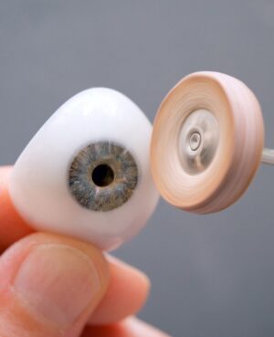 Ocular prosthetics