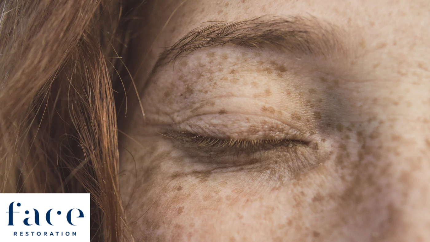 Achieving Youthful Eyes Harnessing the Power of Polynucleotides and